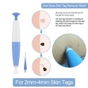 Lescolton auto skin tag remover kit skin tag removal device wart removal