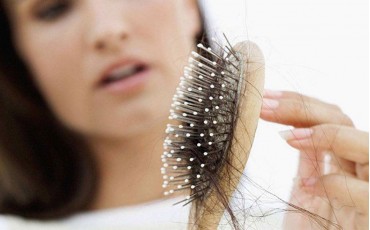 Hair Loss in Women