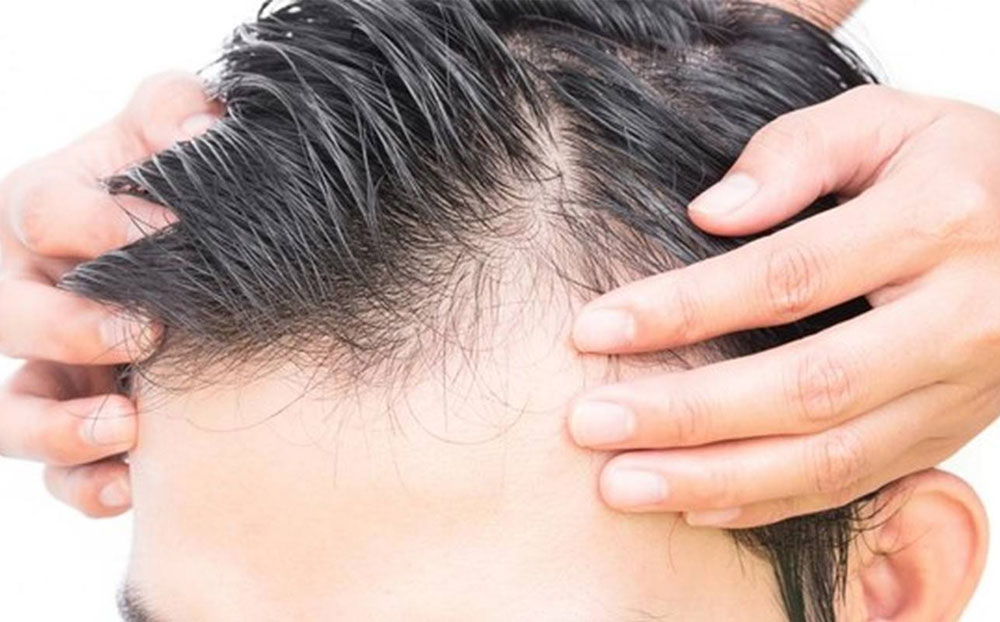 The Evolution of Hair Regrowth Therapy